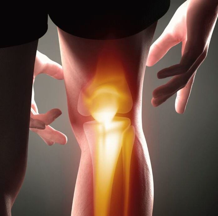 Mi az ízületi gyulladás és arthrosis